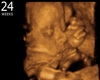 24 Weeks Pregnant Pose