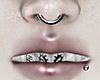 my teeth