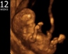 12 Weeks Pregnant Pose