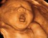 Yawning Ultrasound