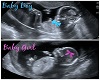 jay twins ultrasound