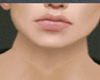 NECK FIX PERFECT