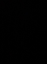Guest_toeknee2