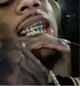Guest_Rarechild6