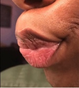 Eeyyuucckk