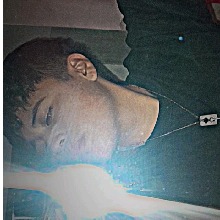 avpic